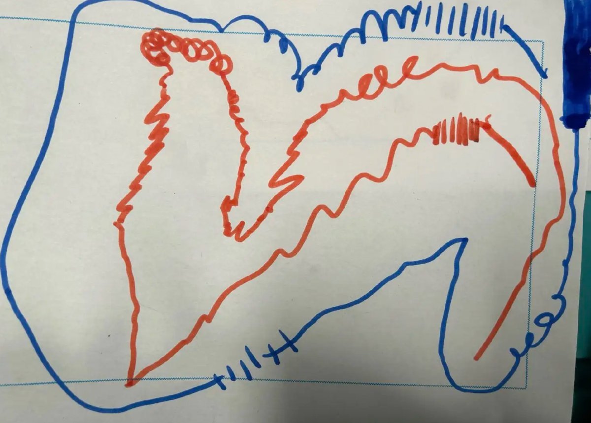 學生畫的一天情緒地圖，橘紅色的鋸齒線被一道圓滑的藍線圍住 · A student's emotion map: jagged orange lines held inside one smooth blue line